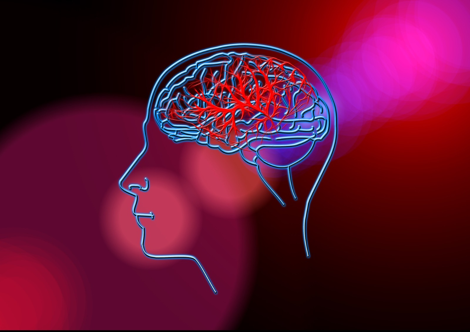 ACV: cómo prevenir un segundo evento cerebrovascular